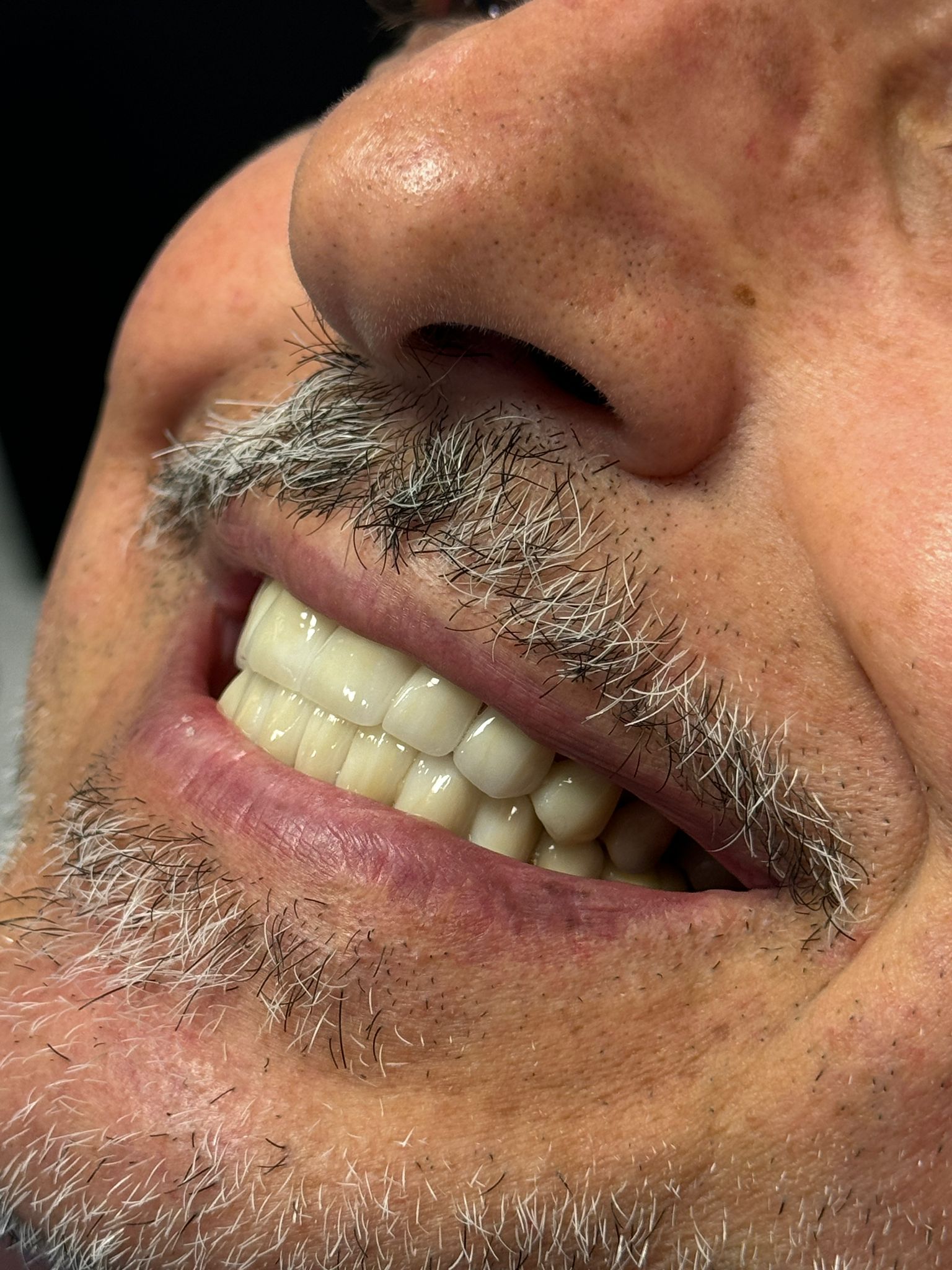 Periodontoloji