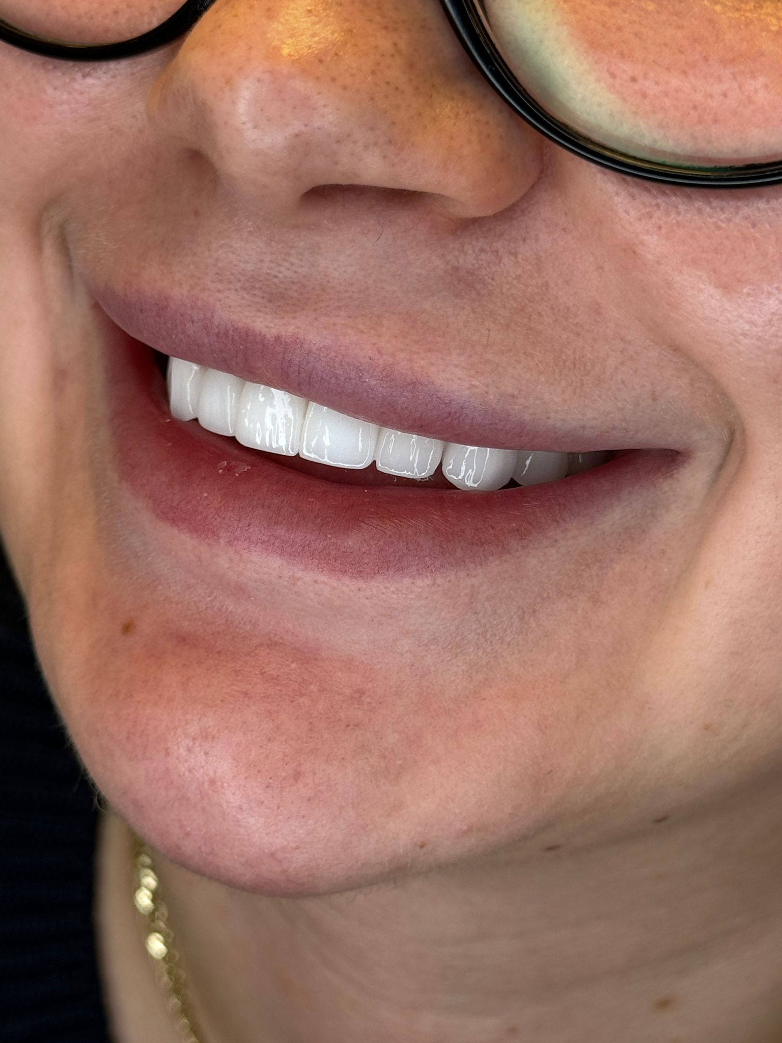 Endodonti